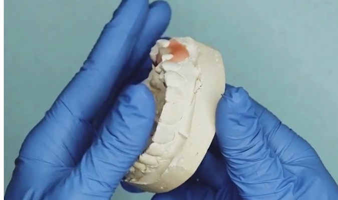 Trabajo de laboratorio dental en Dental Clover Odontología